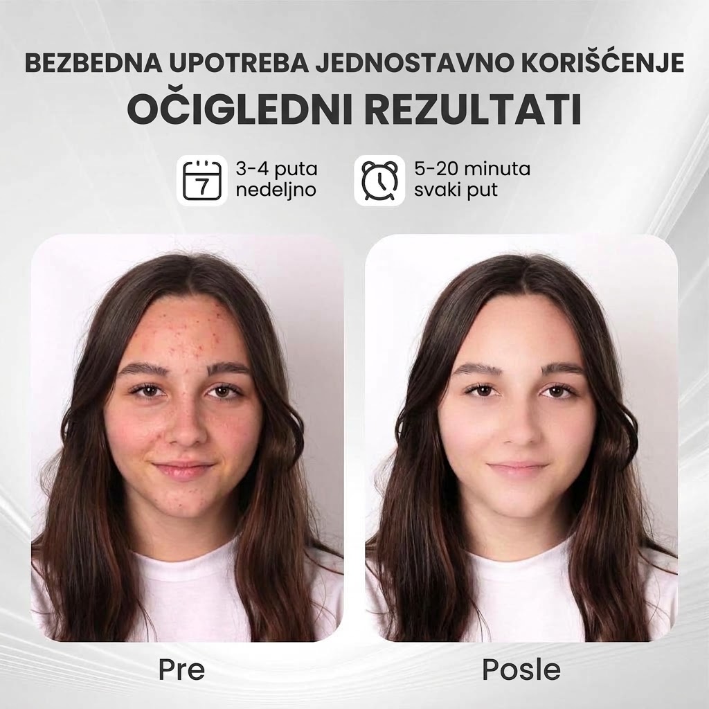LED Maska za Lice sa 7 Boja